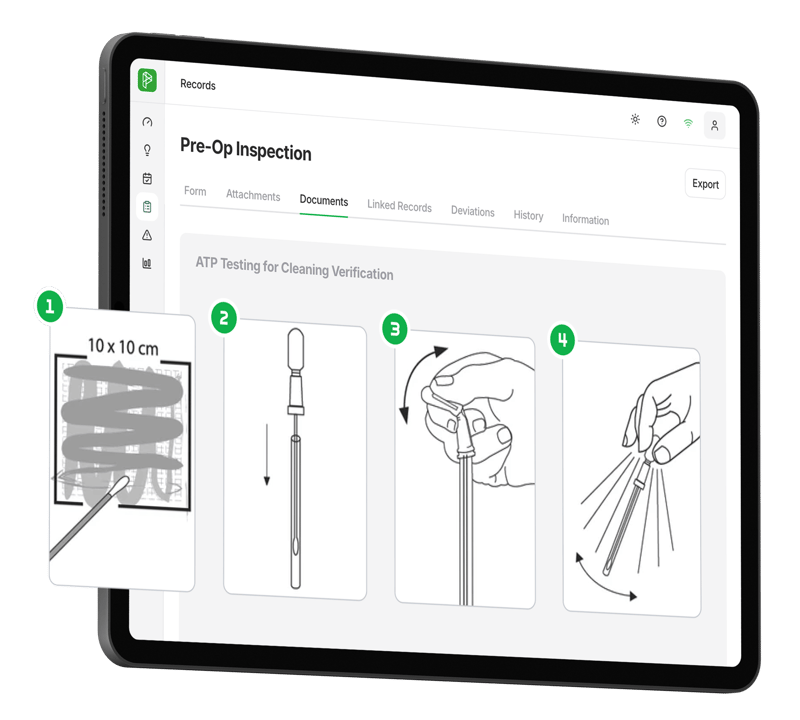 Pre-op guidance side iPad